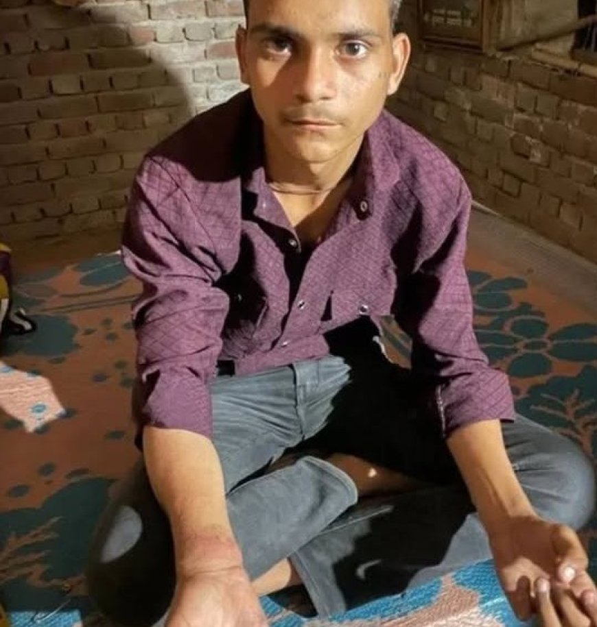 खाकी की बर्बरता ने तोड़ा छात्र का दम, आगरा में पुलिस की पिटाई से दोनों हाथ टूटे; अब कैसे देगा 10वीं की परीक्षा?