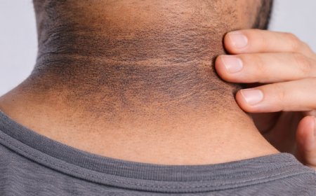 चेहरा साफ लेकिन गर्दन काली? ये 3 घरेलू नुस्खे कुछ ही दिनों में दिखा सकते हैं असर