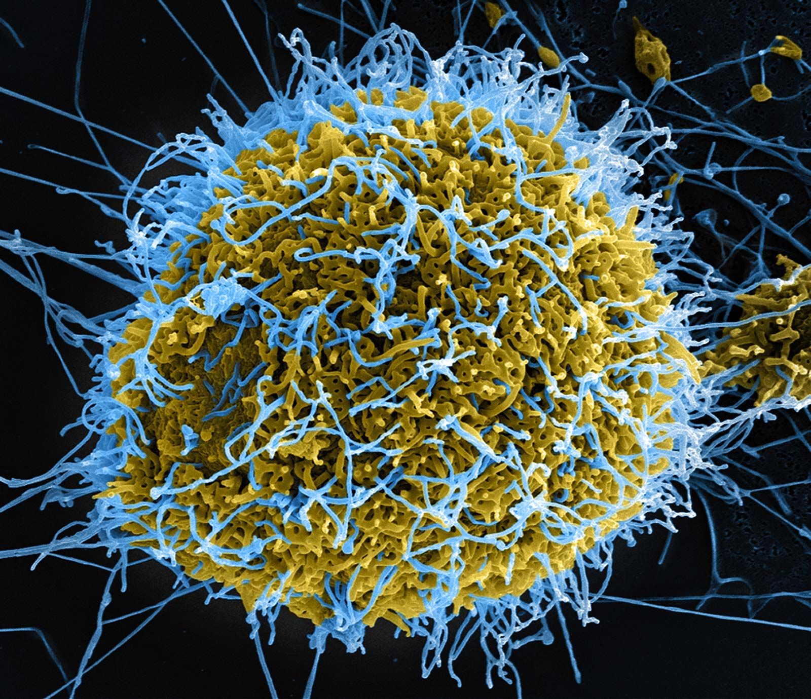 Ebola का खतरनाक रूप! क्या भारत तक पहुंच सकता है बुंडीबुग्यो स्ट्रेन?